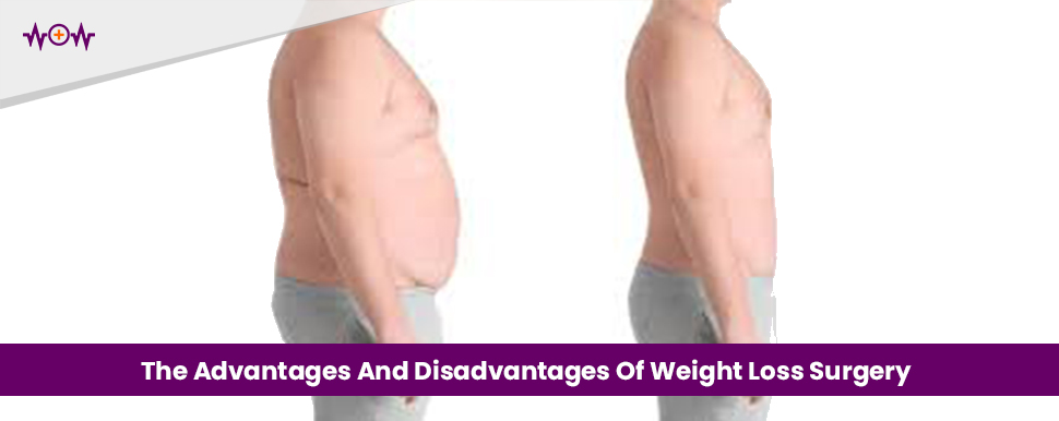 The Advantages And Disadvantages Of Weight Loss Surgery