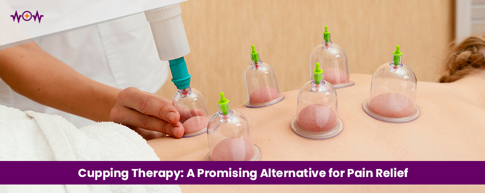 Cupping Therapy: A Promising Alternative for Pain Relief