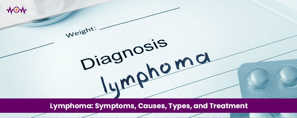 Lymphoma: Symptoms, Causes, Types, and Treatment