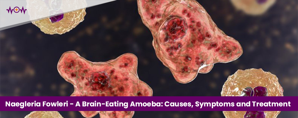 Naegleria Fowleri – A Brain-Eating Amoeba: Causes, Symptoms and Treatment