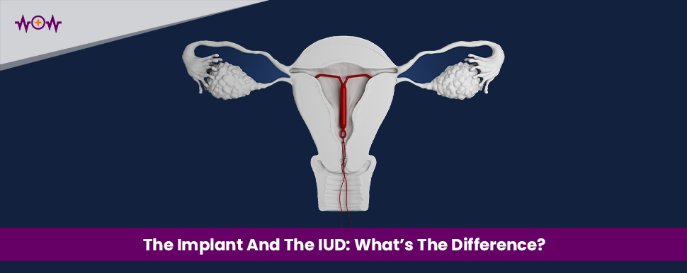 The Implant And The IUD: What’s The Difference?