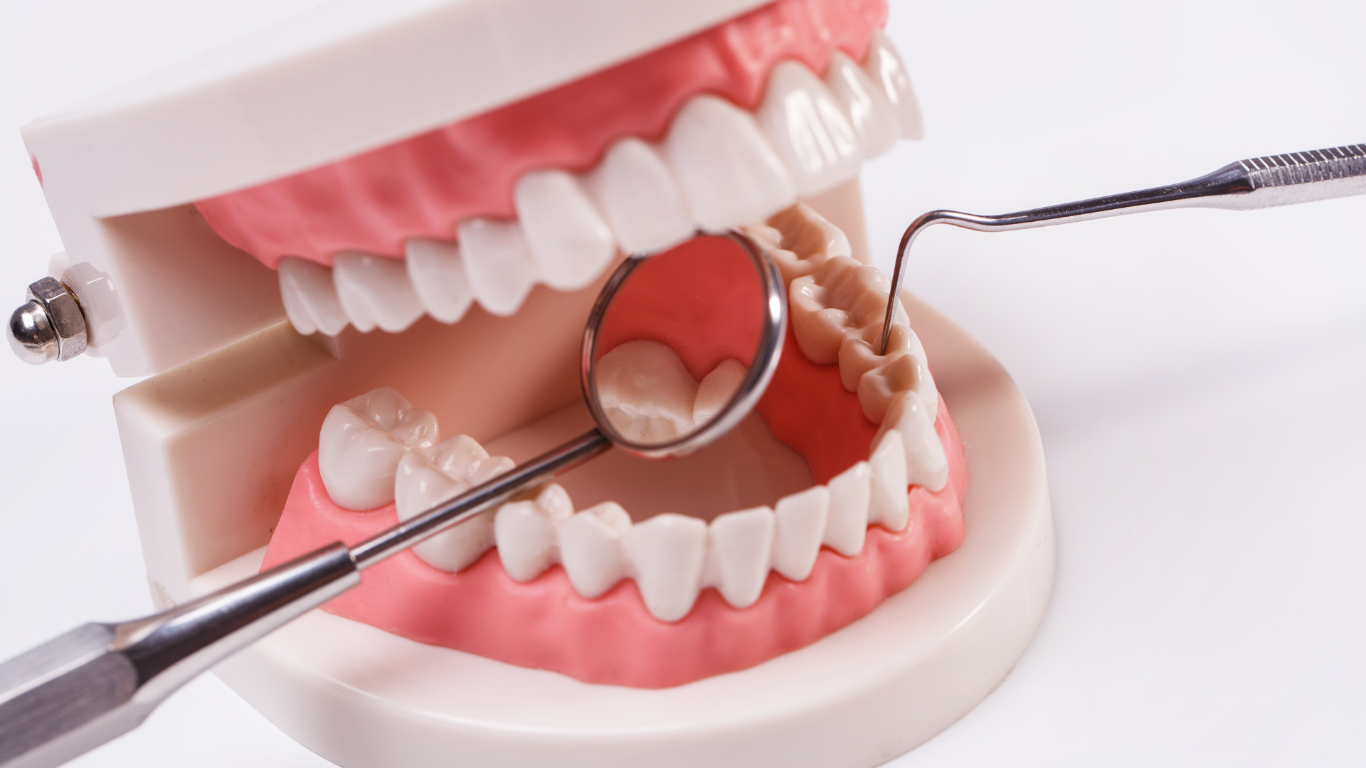 White teeth treatment - dental