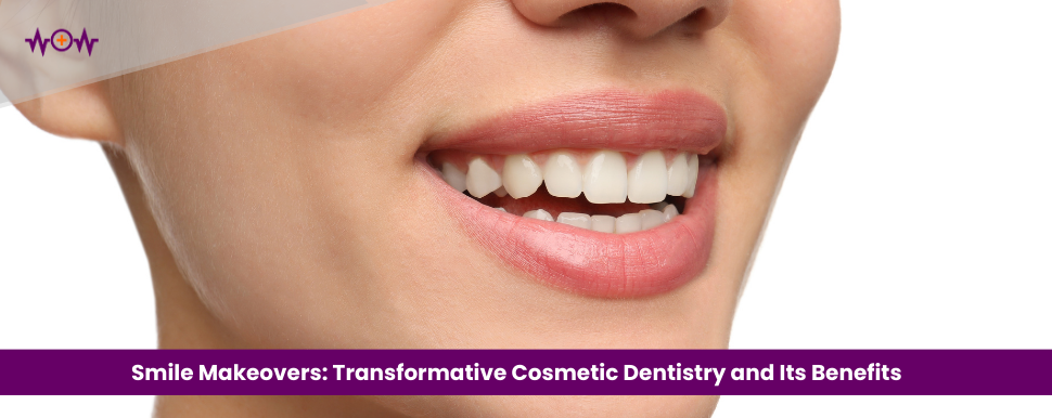 Smile Makeovers: Transformative Cosmetic Dentistry and Its Benefits