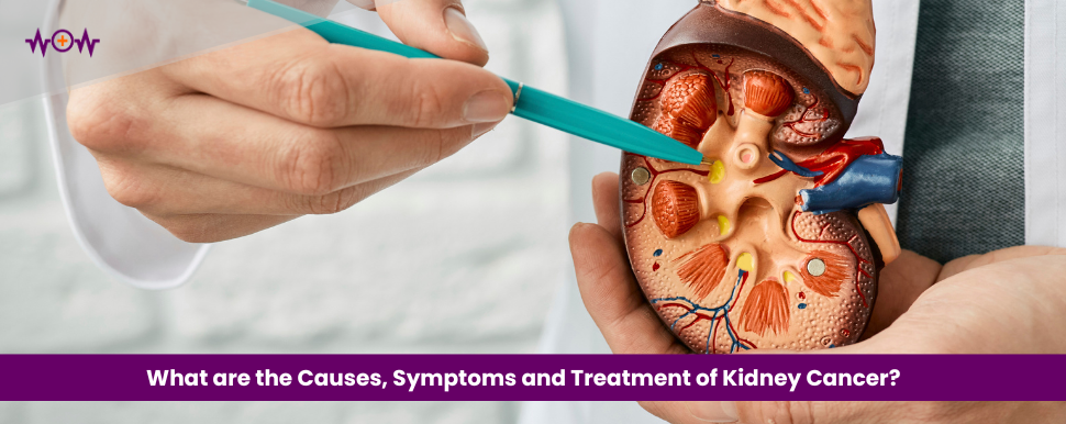 What are the Causes, Symptoms and Treatment of Kidney Cancer?