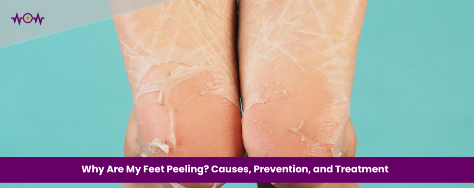 Why Are My Feet Peeling? Causes, Prevention, and Treatment